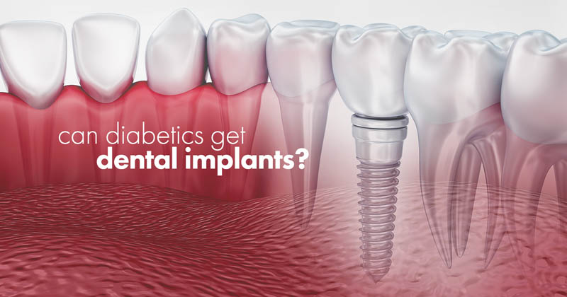 3D illustration of a healthy tooth row and a dental implant in the gums with the question 'Can diabetics get dental implants?'