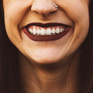Woman smiling showing a gummy smile
