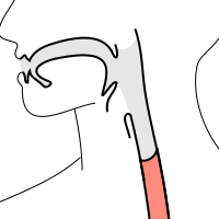 illustration of acid reflux that could erode teeth