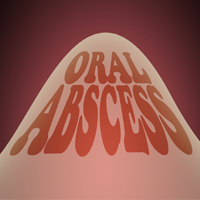 illustration of an oral abscess that needs to be looked at by a dentist
