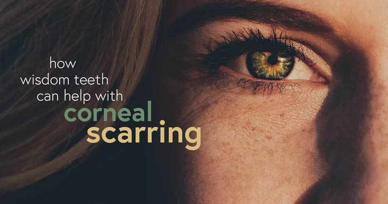 Close-up image of a woman's eye with text overlay discussing the potential benefits of wisdom teeth in treating corneal scarring.